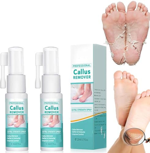 Professioneller Hornhautentferner, extra starkes Spray, 2025 neues Fuß-Hornhautentfernungsspray für Fersenschwielen, abgestorbene Haut und Schwielen an Füßen, Fußhornhautentferner, Pflege