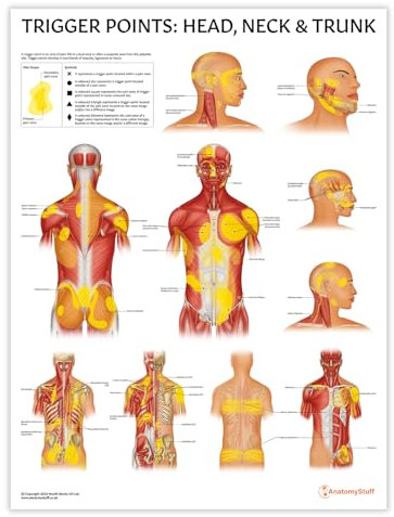 AnatomyStuff Trigger Points: Head, Neck & Runk Poster/Diagramm, 45 x 60 cm, Physiotherapie-Lernwerkzeug, Anatomie-Wanddiagramm