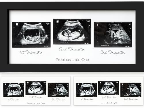 KeaBabies Trio Baby Bilderrahmen für Ultraschallbilder - Bilderrahmen Ultraschallbild Baby, Ultraschall Fotorahmen Schwangerschaft, Ultraschallbilder Rahmen, Geschenke für Werdende Mamas (Onyx Black)