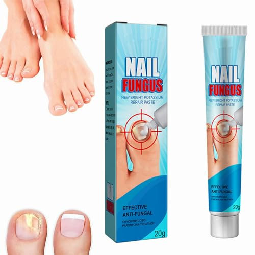 Fungal Nail Cream,For Toenail & Finger Nail,Nail Improve Cream For Damaged Nails,Restores Discolored (1PCS)