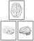 Kunstdruck Din A4 ohne Rahmen 3-teilig - Gehirn Gehirnhälften Mensch Anatomie Zeichnung Medizin Arzt Neurologie Poster Bild