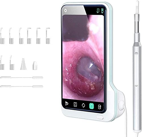 Corsehild Fogner Ear Wax Removal Tool with 5-inch Screen, Visual Ear Picker Endoscope Inspection Camera, Portable Ears Cleaner Cleaning Kit，with LED Light