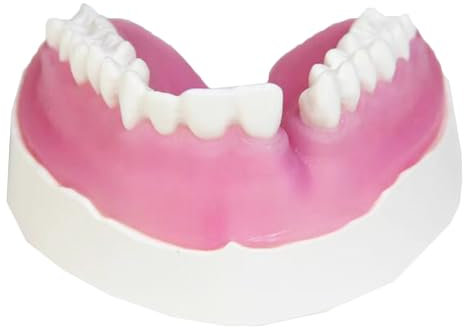 Simulation Kiefer-Gingiva Praxis Modell Taifun Zähne Fissuren Reparatur Dental Modell für Patienten und Dental Student Bildung