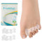 Promifun Zehenspreizer, 1 Paar weiche Gel-Zehenpolster zur Ballenkorrektur, Zehenstretcher zur Linderung von Plantarfasziitis, Krallenzehen, Fußschmerzen bei Männern und Frauen (Klar + L)