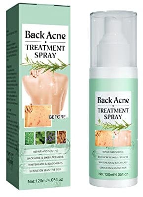 HASAIKA® Rücken Akne Spray, Rücken-Peeling Tiefenreinigung, Akne-Behandlungsspray für Körper, Brust und Rücken, sanft zur Haut, 120 ml