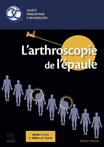 L'arthroscopie de l'épaule (English Edition)