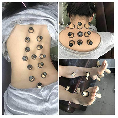 Moxa 30pcs Moxa Artemisia Tube Self-Stick Moxibustion Stickers Therapy Heating Acupuntura Point Warm Meridian Moxa Stick