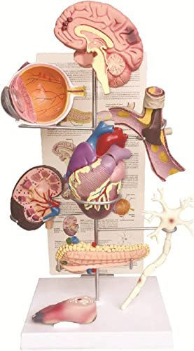 DYTAH Diabetes Display -Modell Hypertonie Modell Diabetes Organmodell Gehirn, Auge, Herz, Niere, Fußmodelle Set Von 8 Professionellen Unterricht