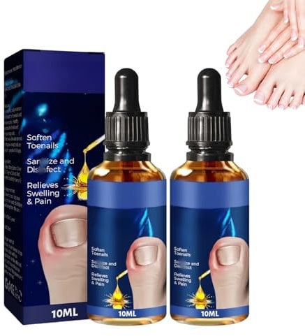 Ingrown Toenail Treatment,Ingrown Toenail Drop,Nail Growth Treatment,Cuticle Care Oil for Ingrown Toenails,Natural Ing-rown Toenail Correction,Nail Repair O-il,Nail Oil Treatment for Damaged Nails