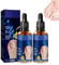 Ingrown Toenail Treatment,Ingrown Toenail Drop,Nail Growth Treatment,Cuticle Care Oil for Ingrown Toenails,Natural Ing-rown Toenail Correction,Nail Repair O-il,Nail Oil Treatment for Damaged Nails