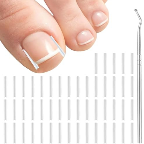 CJQRL 51 Pièces Kit correcteur d'ongles incarnés Bandes de redressement d'ongles indolores avec lève-ongles - Kit d'outils pour ongles incarnés facile à utiliser