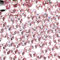 1000pcs 2mm Flat Back Non-Stick Rhinestone Crystal Diamantes Nail Art & Craft Scrapbooking Embellishments 90 Available Colours (2mm, Light Pink #21)
