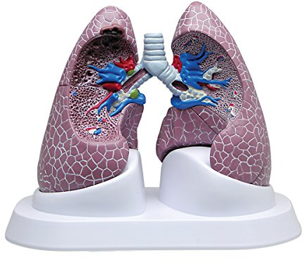 GPI Anatomicals 3110 Lungen-Set mit Pathologien, 1018749