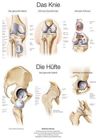 LehrtafelDas Knie/Die Hüfte (deutsch), 70x100cm