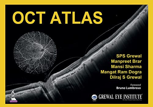 OCT Atlas (English Edition)