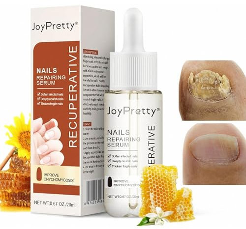 Somnr Nail Cuticle Oil, Cuticle Care Oil for Fungal Nail & Toenails Strength, Nail Treatment for Dry & Damaged Nails, Organic Nail Oils for Moisturizing and Repairing Cracked Nail - 20ml