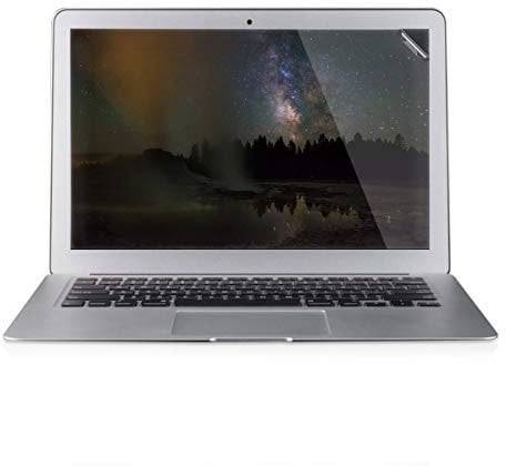 kwmobile Pellicola Protettiva Universale per Schermo Laptop per Notebook 39,6cm (15,6)