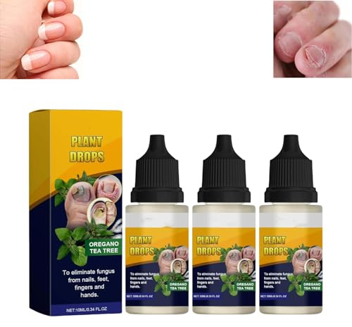 Pflanzentropfen – Pflanzentropfen, Nagelpilz, Pflanzentropfen für die Nagelpflege, Oregano, Teebaum, Oreganoöl, Nagelunterstützung, Nagelpflege, Feuchtigkeitscreme für Zehennägel, 3 Stück