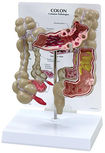 GPI Anatomicals W33364 Dickdarm Modell