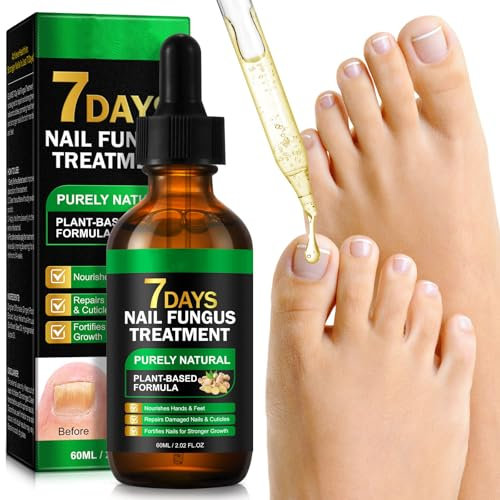 7 Days Nail Fungus Treatment - Fungal Nail Treatment for Toenails Extra Strong - Ginger Nail Treatment for Fungal Infections - Antifungal nail treatment for Nails Natural Shine