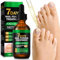 7 Days Nail Fungus Treatment - Fungal Nail Treatment for Toenails Extra Strong - Ginger Nail Treatment for Fungal Infections - Antifungal nail treatment for Nails Natural Shine