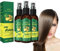 MQSHUHENMY Shouga Kingu Haarwachstumsöl, 7 Tage Ingwer Keimöl, Japanisches Haarwachstumsspray (3 Stück)