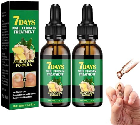 Ginger Nail Treatment Nail Support Nail Care,Ginger Nail Growth Serum,7days Nail Treatment,Ginger Cuticle Care Oil for Nails,Nail Strengthener For Damaged Nails,Nourishing Moisturizing (2 Pcs)
