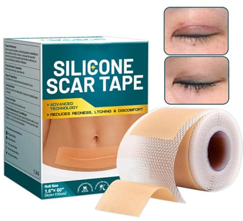 Bandes De Cicatrices En Silicone – Rouleau De Ruban Adhésif Pour Enlever Les Cicatrices, Feuilles De Gel Doux Pour Cicatrices, Ruban Réutilisable | Patchs Cutanés Pour Cicatrices Chirurgicales, Cicatr