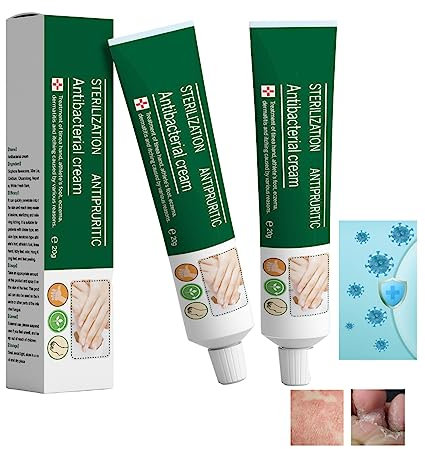 Crema Antimicotica A Base Di Erbe Per Mani, Crema A Base Di Erbe Per Eliminare Il Fungo Del Piede, Crema Per Funghi Dell'unghia Del Piede, Crema Per La Cura Della Pelle Dei Funghi (2Pcs)