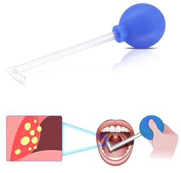 Mandelsteine Entfernen,Tonsillenstein Entferner,Tonsillenstein Entferner Zum Entfernen Von Tonsillensteine,Mandelsteine Schröpfglas, Wirksame Mundreinigung für Einen Frischeren Atem(Blau)