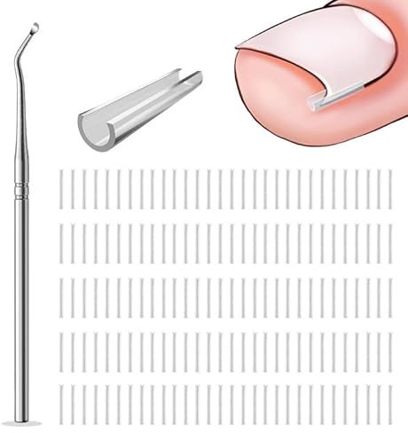 Ongle Incarné Gros Orteil 150PCS Ongles Incarnés Pieds Ongle Incarné Orteil Outil Pour Ongles Incarnés Ongles Incarnés Pieds Correcteur kit Ongle Incarne Pieds Pour Soins des Pieds