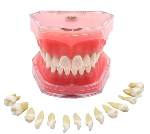 UIGJIOG Modèle de Dents Amovibles modèle Simulation Restauration Dentaire et d'insertion d'implants Pont Modèle d'enseignement pédagogique pour la Pratique l'enseignement avec Tournevis pour mor