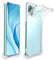 ebestStar - Cover per Xiaomi Mi 11 Lite, Mi 11 Lite 5G, NE, Custodia Silicone Trasparente, Protezione TPU Antiurto, Bordi Rinforzati, Trasparente