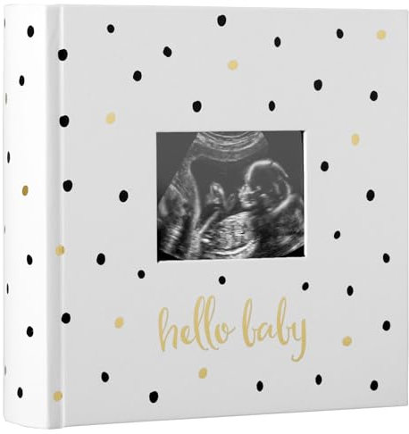 Pearhead Baby-Fotoalbum, Babybuch Andenken für frischgebackene und werdende Eltern, geschlechtsneutrales Baby-Accessoire, Schwarz und Gold gepunktet