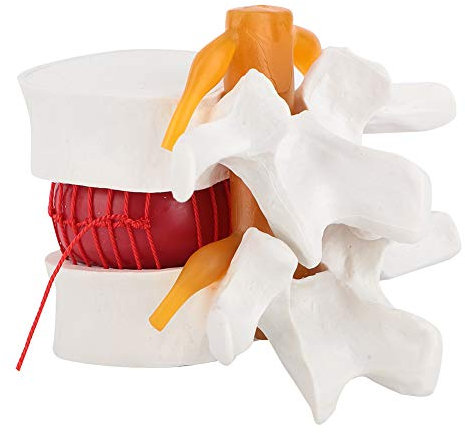 Anatomie Menschen Lendenwirbelsäule, 1: 1, 5 Demonstrationsmodell Menschlichen Lendenwirbelsäulen Modells Medizinischen Demonstration