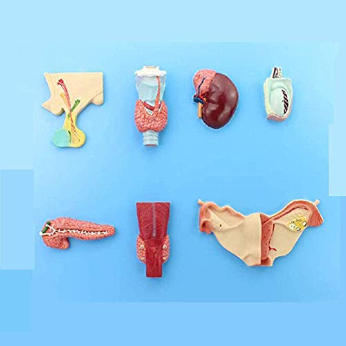 LBYLYH Atherosklerose Modell Pädagogisches Modell - 4-teiliger Arterienmodell - Anatomische Arterienkörper-Replik mit Plattenansammlung für Ärzte-Werkzeug