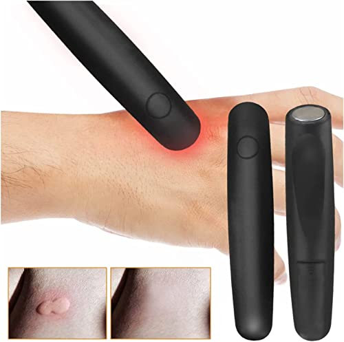 XZincer Insektenstichheilers, Elektronischer Anti-juckreiz-stift, Mückenstich Elektro Stichheiler, zur Behandlung von Juckreiz, Brennen, Schmerz Und Schwellung Insektenstichen Lindert (A, One Size)