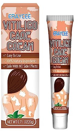 Crema vitiligine,Crema vitiligine contro macchie bianche sulla pelle 20 g – Crema facile da applicare contro le macchie bianche sulla pelle Migliora i melanociti epidermici, riduce la pologmasi bianca