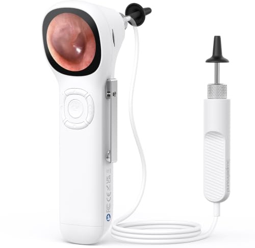 ScopeAround Wireless Digital Otoscope with IPS Screen, 720p HD Smart Visual Ear Camera, Ear Scope Otoscope Camera with 6 LED Lights, Ear Wax Removal Tool Camera, Plug & Play
