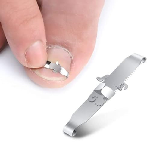 BEZOX 2 Pcs Ingrown Toenail Tools, Ingrown Toenail Correction Buckle and Toenail Lifter for Paronychia Treatment and Ingrown Toe Nails and - Surgical Grade Stainless Steel -Metal Boxes