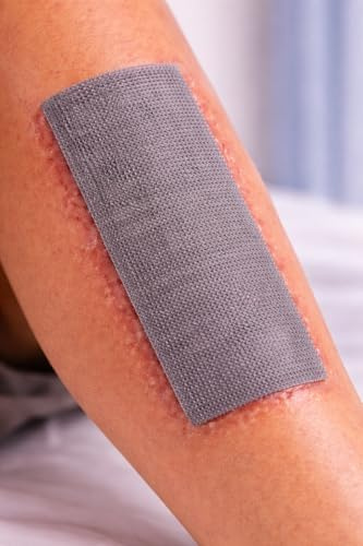 MediSale Atrauman Ag 10 cm x 20 cm, silberimprägnierte, nicht haftende Wundverband, antimikrobielle Wundversorgung, 3 Stück
