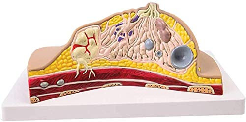 Modelo De Médico Y Libro De Texto Modelo Anatómico De Mama - Modelo De Anatomía De Órganos - Mama Femenina - Sección Transversal De Mama Anatómica Médica Patológica