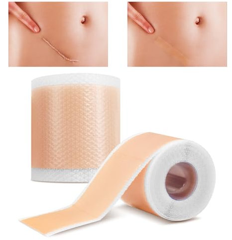 Zonoori Silicone Scar Tape, 4cm X 3m Silikon Narbenpflaster, Silikonpflaster für Narben