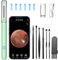 LMECHN Ear Wax Removal, Ear Camera Otoscope with LED Light, Ear Wax Removal Kit with 1080P, 3.5 mm Waterproof Ear Endoscope, Ear Cleaning Kit for iPhone, iPad, Android Phones-Green