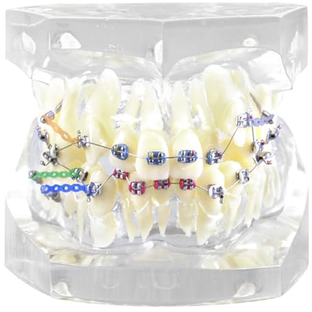 Modelo de dientes de tipodonte para ortodoncia dental con brackets metálicos y ligaduras para enseñanza y práctica.