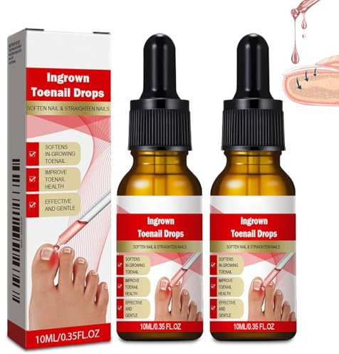 Ingrown Toenail Care Solution, Ingrowing Toenail Support, Nail Nourishing Formula, Natural Ingrown Toenail Relief, Nail Care Drops, Toenail Softening Liquid, Toe Nail Conditioning Treatment (10ml*2)
