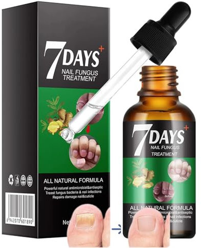 Nail Fungas Treatmant for Toenail - 30ml + Free 3ml Nail Pen - Extra Strength for Fingernails & Toenails