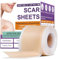 Silikon Narbenpflaster, Narbenpflaster Silikon, Silikonpflaster Gegen Falten & Silicone Scar Tape, Narbenpflaster Gegen Falten mit Silikonpflaster Für Narben, Silikon Pflaster & Silicone Scar Sheets