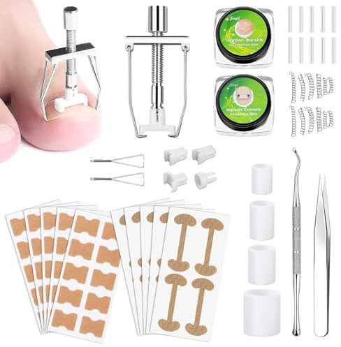 Ingrown Toenail Removal Kit Ingrown Toenail Treatment Tool Kit Ingrown Toenail Corrector Tools with Toenail Braces, Podiatry Tools, Ingrown Toenail Corrector Strips and Patch for Toe Pain Relief