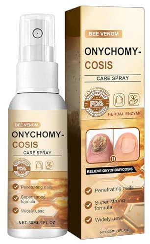 Toenail Cleaner Spray, Toe Nail Strengthener, Nail Care Spray Repair, Toenail Repair Solution, Nail Strengthener Spray, Grey Nail Repair, Broken Nail Repair, Cracked Nail Solution, 30ml Nail Repair
